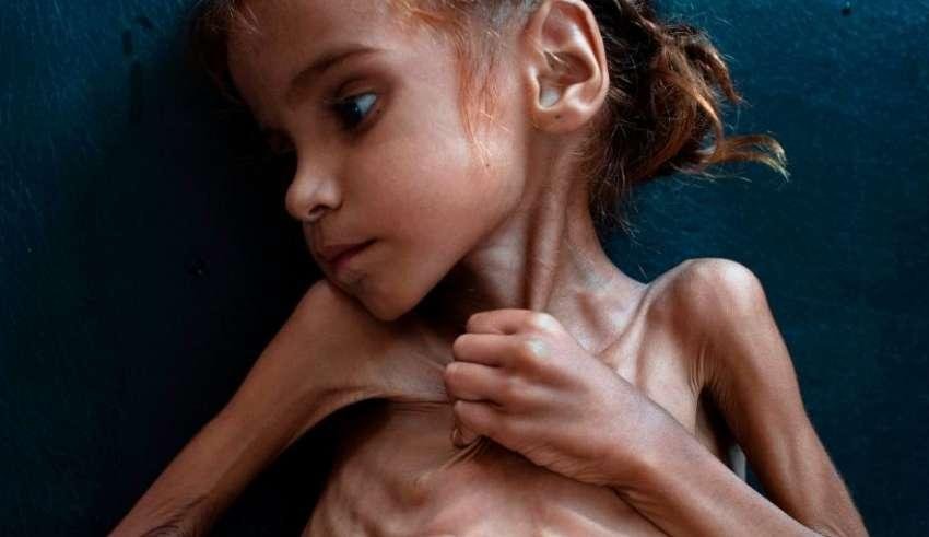 https://jornalnoroeste.com/uploads/images/2018/11/criancas-que-morrem-de-fome-bg-125-a00c6.jpg