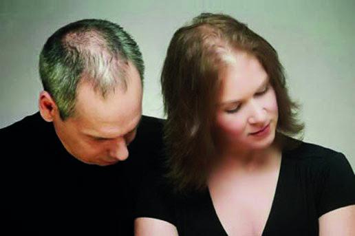 Calvície feminina x calvície masculina Quais são as diferenças?