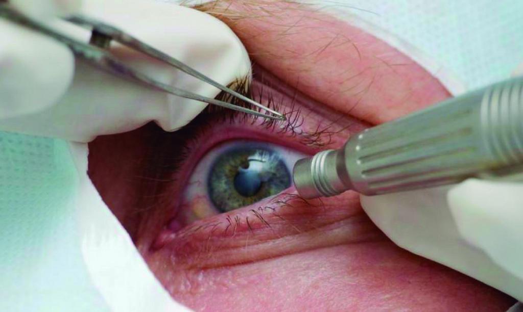 Pandemia causa queda de 27 milhões de procedimentos de saúde em 2020