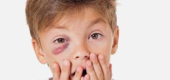 Traumas oculares na infância podem levar à cegueira