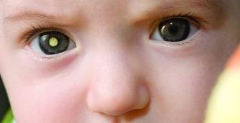 Retinoblastoma: câncer no olho de bebês pode ser detectado em...