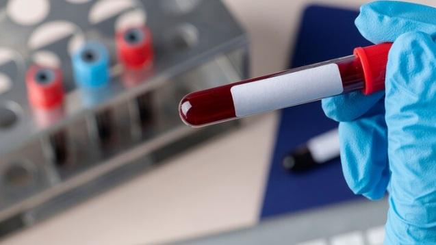 Talassemia: São Paulo e Paraná lideram o número de atendimentos