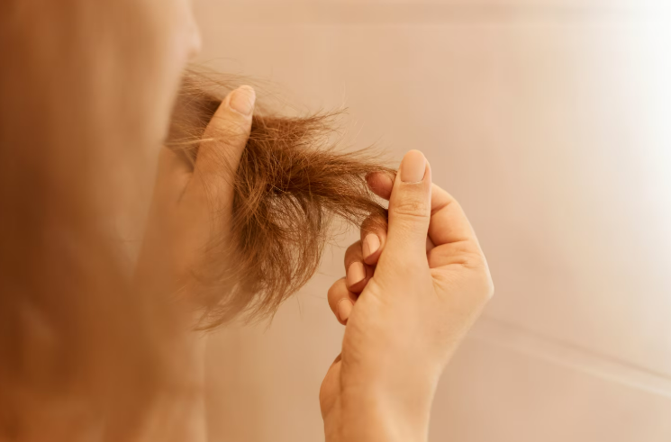 /images/2026/09/queda-de-cabelo-pode-ser-sinal-de-deficiencia-de-ferro-medico-explica.png